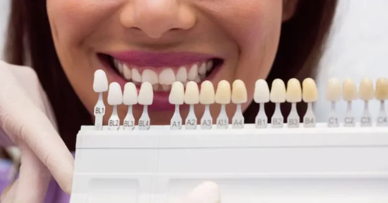 Veneers are thin shells, typically made from porcelain or composite resin, that are custom-designed to cover the front surface of teeth.