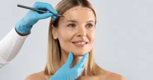 Lowering forehead surgery, or hairline advancement surgery, is a cosmetic surgical procedure designed to reduce the height of the forehead by moving the hairline forward.